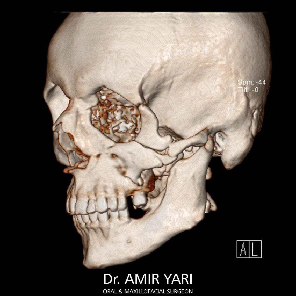 Dr. Amir Yari, Oral and maxillofacial surgery