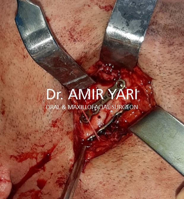 Amir Yari, Oral and Maxillofacial Surgery